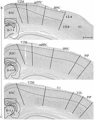 Organization of Posterior Parietal–Frontal Connections in the Rat